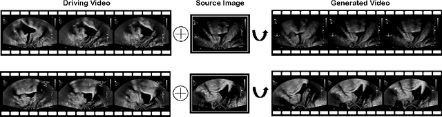 Figure 1 for Weakly-supervised High-fidelity Ultrasound Video Synthesis with Feature Decoupling