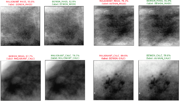 Figure 4 for Multimodal Breast Lesion Classification Using Cross-Attention Deep Networks