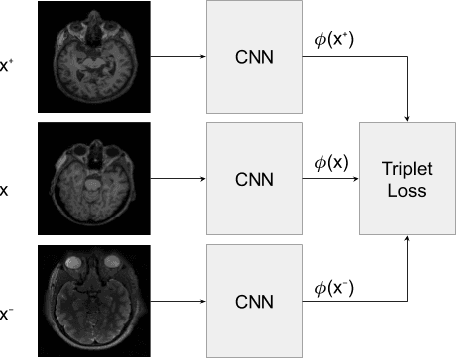 Figure 1 for Few-shot Learning with Deep Triplet Networks for Brain Imaging Modality Recognition