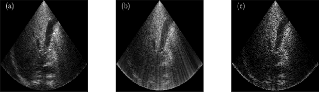 Figure 1 for Deep Unfolded Recovery of Sub-Nyquist Sampled Ultrasound Image