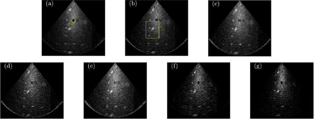 Figure 4 for Deep Unfolded Recovery of Sub-Nyquist Sampled Ultrasound Image