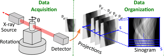 Figure 1 for Masked Sinogram Model with Transformer for ill-Posed Computed Tomography Reconstruction: a Preliminary Study