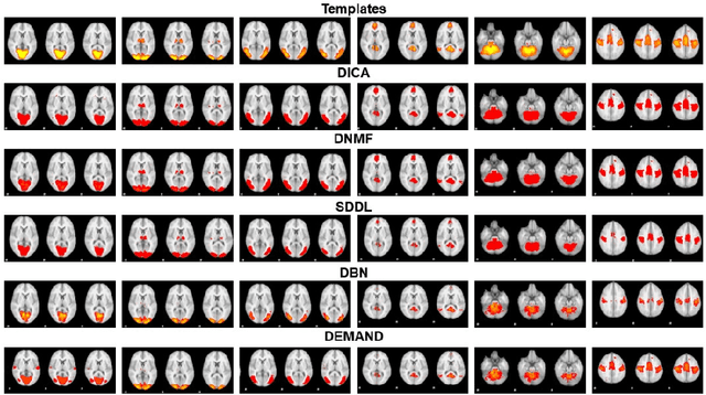 Figure 1 for DEMAND: Deep Matrix Approximately NonlinearDecomposition to Identify Meta, Canonical, and Sub-Spatial Pattern of functional Magnetic Resonance Imaging in the Human Brain