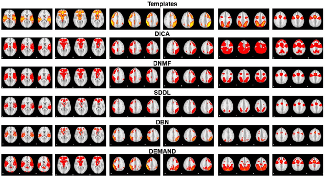 Figure 2 for DEMAND: Deep Matrix Approximately NonlinearDecomposition to Identify Meta, Canonical, and Sub-Spatial Pattern of functional Magnetic Resonance Imaging in the Human Brain