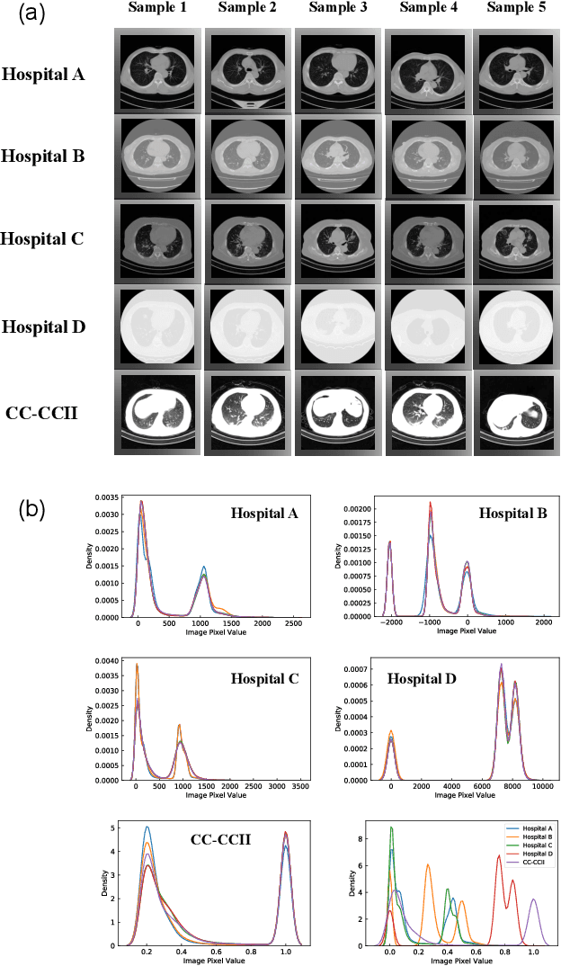 Figure 1 for Robust Weakly Supervised Learning for COVID-19 Recognition Using Multi-Center CT Images