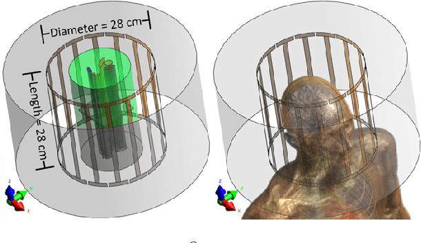 Figure 3 for Physics-Coupled Neural Network Magnetic Resonance Electrical Property Tomography (MREPT) for Conductivity Reconstruction