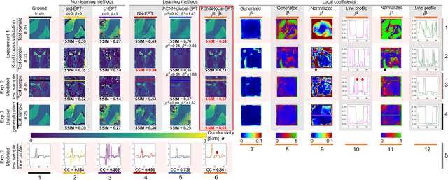 Figure 4 for Physics-Coupled Neural Network Magnetic Resonance Electrical Property Tomography (MREPT) for Conductivity Reconstruction