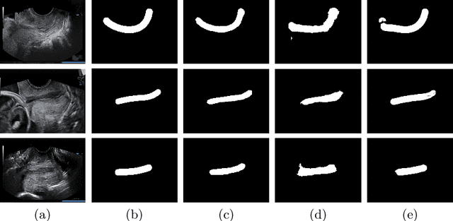 Figure 3 for Spontaneous preterm birth prediction using convolutional neural networks