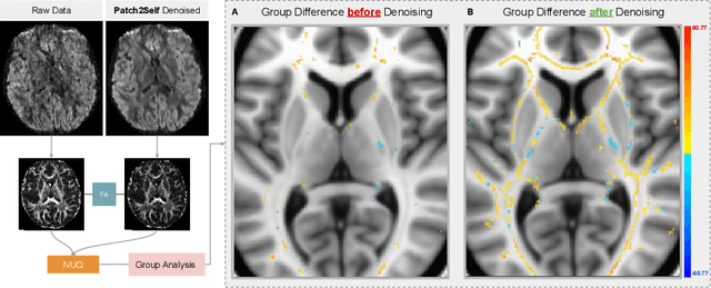 Figure 3 for NUQ: A Noise Metric for Diffusion MRI via Uncertainty Discrepancy Quantification