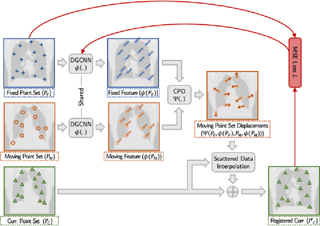 Figure 1 for Learning Deformable Point Set Registration with Regularized Dynamic Graph CNNs for Large Lung Motion in COPD Patients