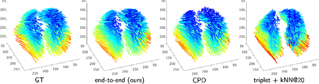 Figure 4 for Learning Deformable Point Set Registration with Regularized Dynamic Graph CNNs for Large Lung Motion in COPD Patients