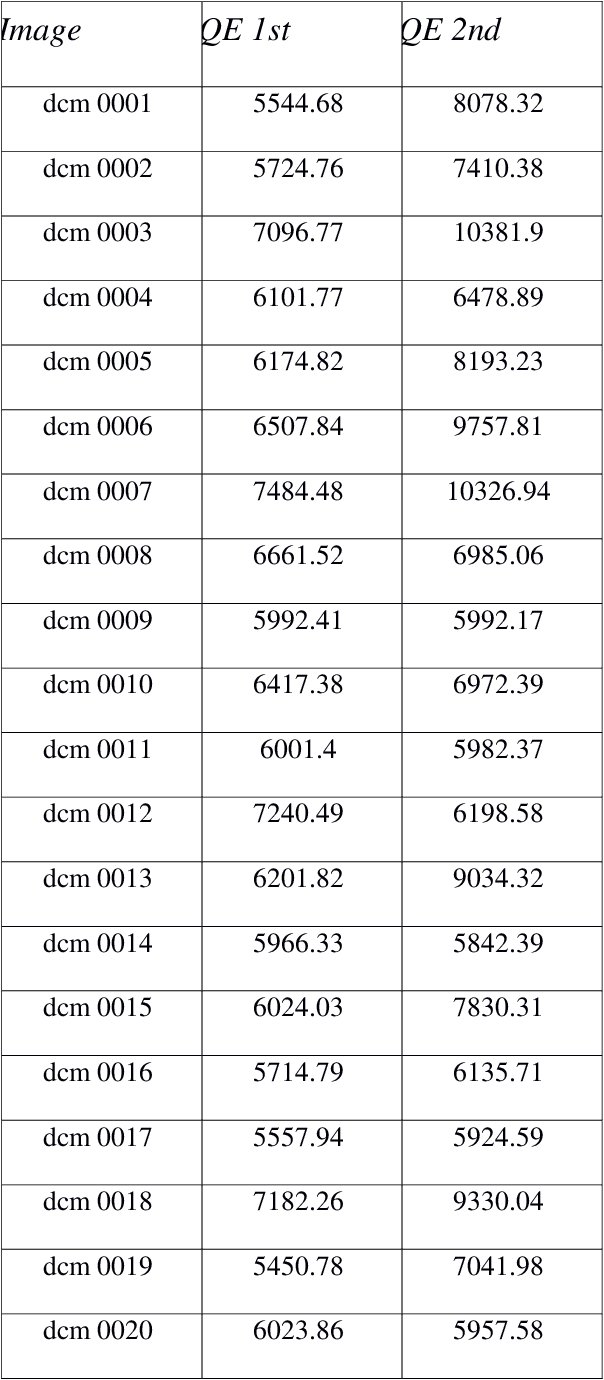 Figure 2 for Detection of small changes in medical and random-dot images comparing self-organizing map performance to human detection