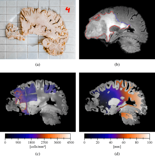 Figure 4 for Initial condition assessment for reaction-diffusion glioma growth models: A translational MRI/histology (in)validation study