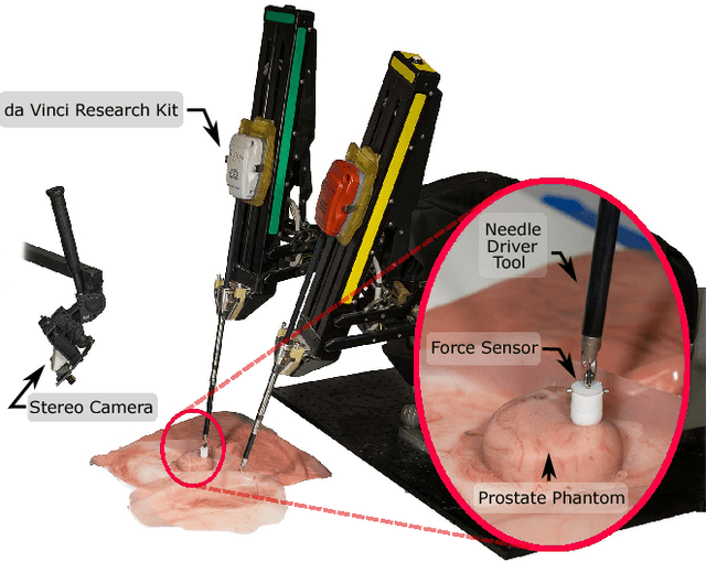 Figure 1 for A surgical system for automatic registration, stiffness mapping and dynamic image overlay