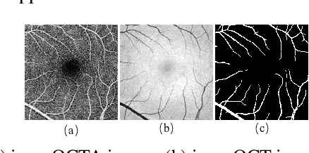 Figure 1 for Unsupervised Domain Adaptation for Cross-Modality Retinal Vessel Segmentation via Disentangling Representation Style Transfer and Collaborative Consistency Learning