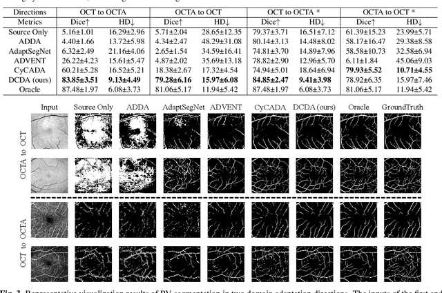 Figure 4 for Unsupervised Domain Adaptation for Cross-Modality Retinal Vessel Segmentation via Disentangling Representation Style Transfer and Collaborative Consistency Learning