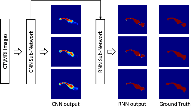 Figure 1 for Pancreas Segmentation in CT and MRI Images via Domain Specific Network Designing and Recurrent Neural Contextual Learning