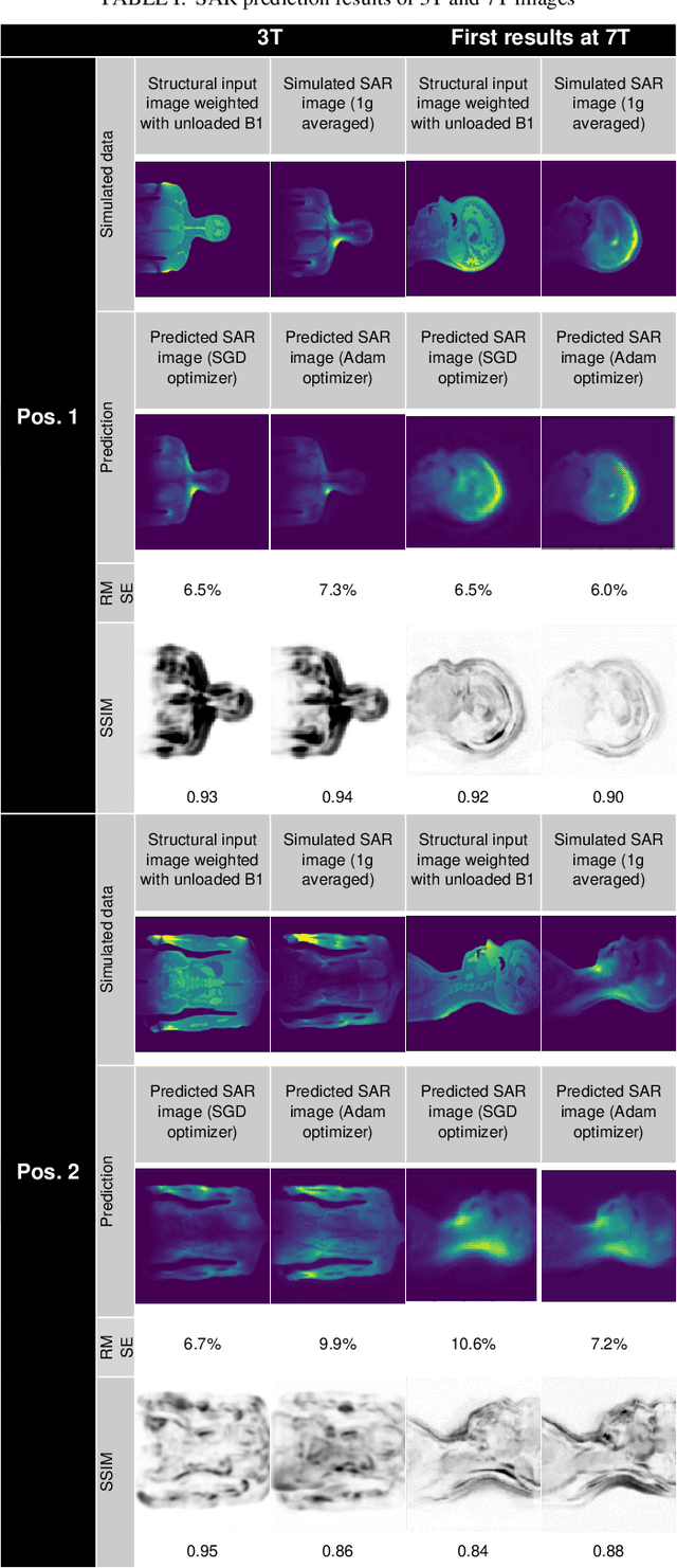 Figure 1 for MRSaiFE: Tissue Heating Prediction for MRI: a Feasibility Study