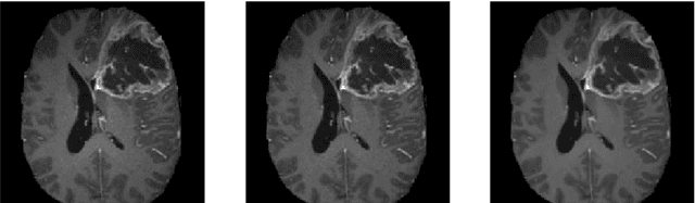 Figure 1 for Brain Tumor Segmentation using an Ensemble of 3D U-Nets and Overall Survival Prediction using Radiomic Features