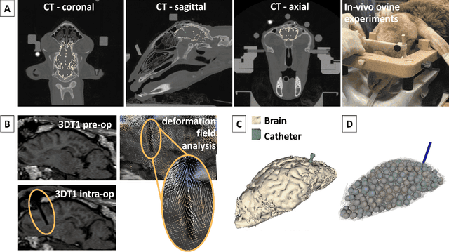 Figure 4 for Position-based Dynamics Simulator of Brain Deformations for Path Planning and Intra-Operative Control in Keyhole Neurosurgery