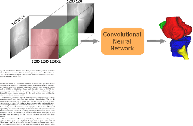 Figure 1 for End-To-End Convolutional Neural Network for 3D Reconstruction of Knee Bones From Bi-Planar X-Ray Images