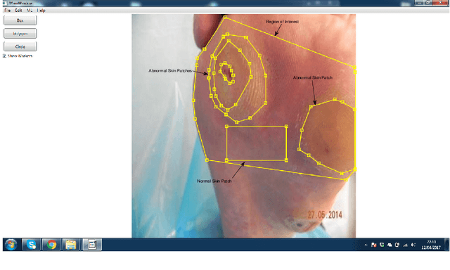Figure 1 for DFUNet: Convolutional Neural Networks for Diabetic Foot Ulcer Classification