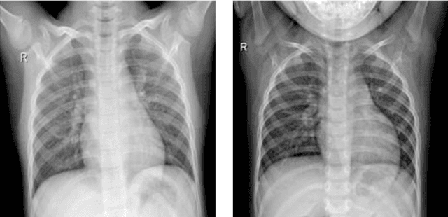 Figure 3 for Automatic Detection of Coronavirus Disease (COVID-19) Using X-ray Images and Deep Convolutional Neural Networks