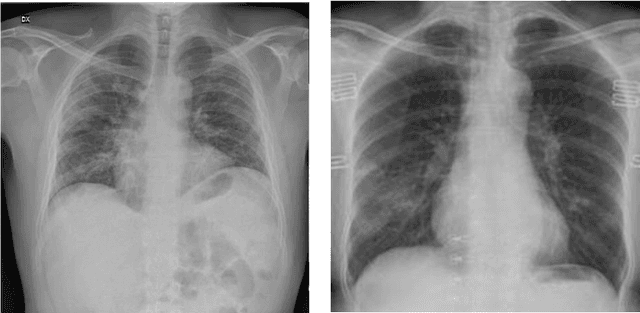 Figure 4 for Automatic Detection of Coronavirus Disease (COVID-19) Using X-ray Images and Deep Convolutional Neural Networks