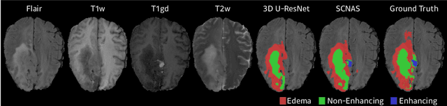 Figure 4 for Scalable Neural Architecture Search for 3D Medical Image Segmentation