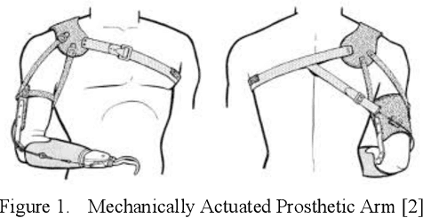 Figure 1 for Design of an Affordable Prosthetic Arm Equipped with Deep Learning Vision-Based Manipulation