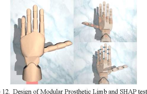 Figure 4 for Design of an Affordable Prosthetic Arm Equipped with Deep Learning Vision-Based Manipulation