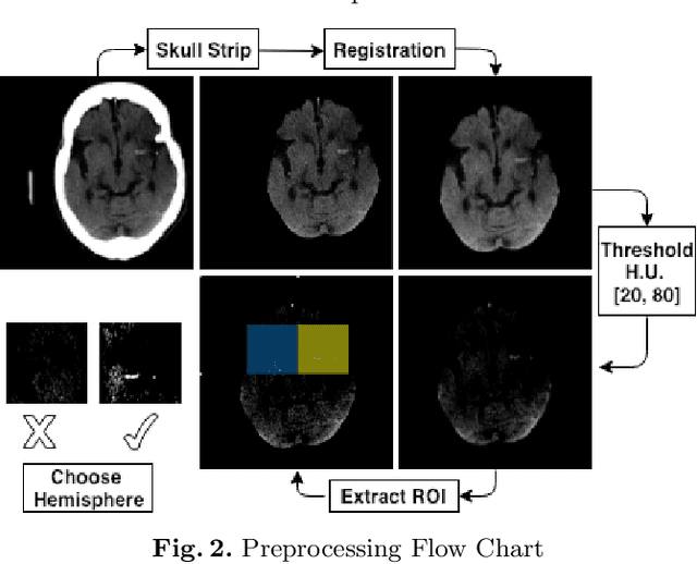 Figure 3 for Automated Computer Evaluation of Acute Ischemic Stroke and Large Vessel Occlusion