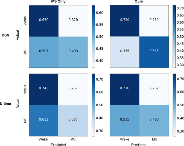 Figure 3 for Automatic Micro-sleep Detection under Car-driving Simulation Environment using Night-sleep EEG