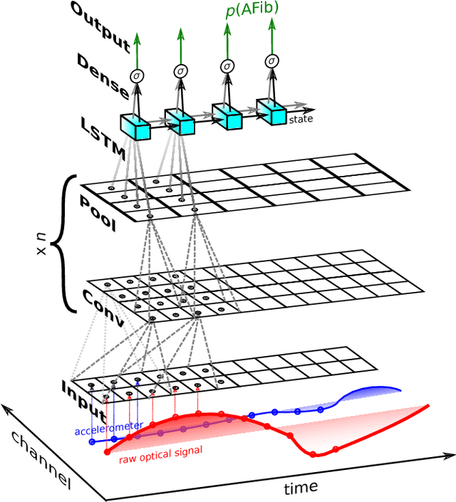 Figure 2 for End-to-end Deep Learning from Raw Sensor Data: Atrial Fibrillation Detection using Wearables