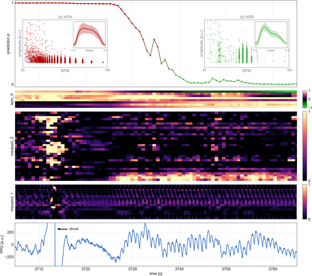 Figure 3 for End-to-end Deep Learning from Raw Sensor Data: Atrial Fibrillation Detection using Wearables