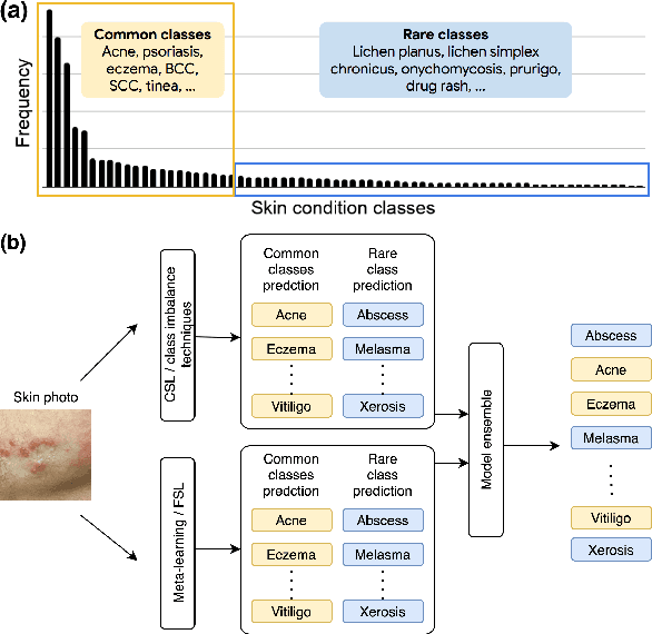 Figure 1 for Addressing the Real-world Class Imbalance Problem in Dermatology