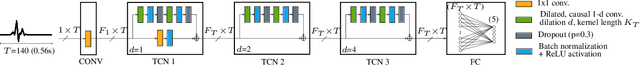Figure 1 for ECG-TCN: Wearable Cardiac Arrhythmia Detection with a Temporal Convolutional Network