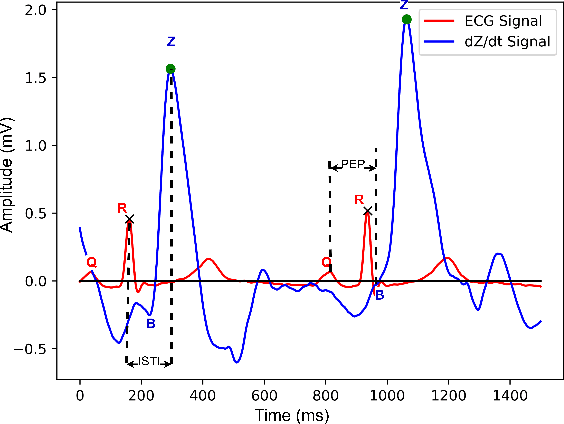 Figure 1 for StressNet: Detecting Stress in Thermal Videos