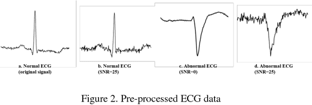 Figure 2 for A Comparison of 1-D and 2-D Deep Convolutional Neural Networks in ECG Classification