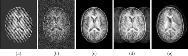 Figure 3 for A Decoupled Uncertainty Model for MRI Segmentation Quality Estimation