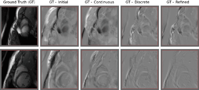 Figure 3 for Rigid Slice-To-Volume Medical Image Registration through Markov Random Fields