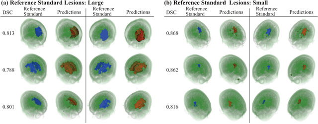 Figure 4 for Automatic Post-Stroke Lesion Segmentation on MR Images using 3D Residual Convolutional Neural Network