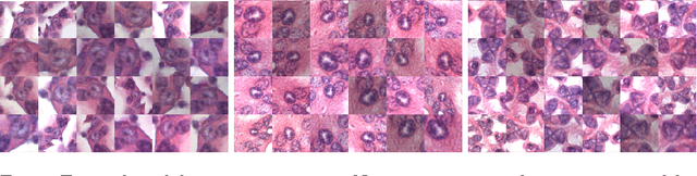 Figure 1 for Cutting out the middleman: measuring nuclear area in histopathology slides without segmentation