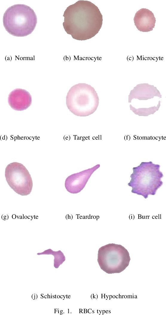 Figure 1 for Red Blood Cell Segmentation with Overlapping Cell Separation and Classification on Imbalanced Dataset
