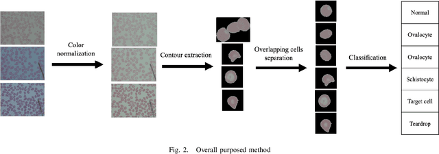 Figure 2 for Red Blood Cell Segmentation with Overlapping Cell Separation and Classification on Imbalanced Dataset