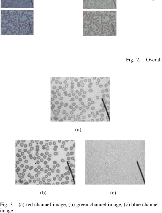 Figure 3 for Red Blood Cell Segmentation with Overlapping Cell Separation and Classification on Imbalanced Dataset