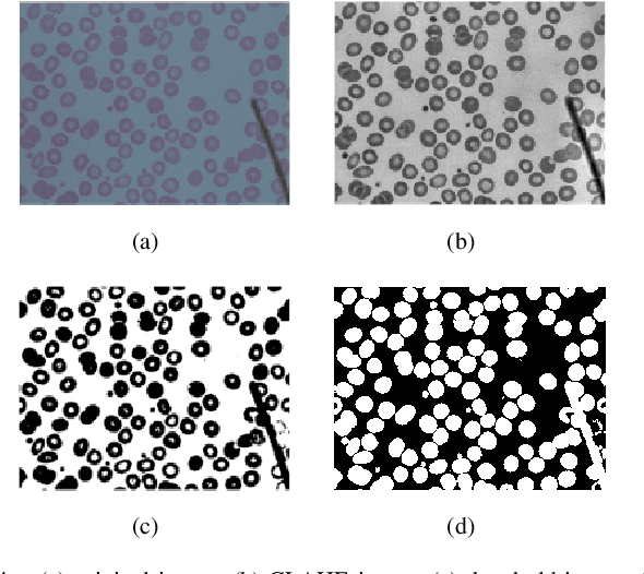 Figure 4 for Red Blood Cell Segmentation with Overlapping Cell Separation and Classification on Imbalanced Dataset