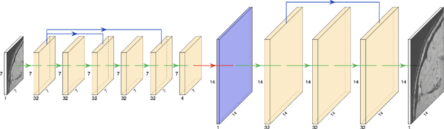 Figure 2 for Convolutional Neural Networks with Intermediate Loss for 3D Super-Resolution of CT and MRI Scans