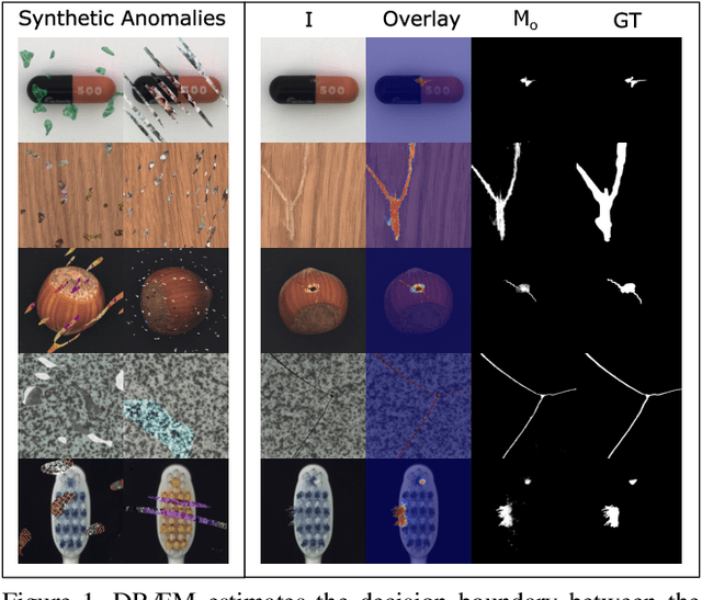 Figure 1 for DRÆM -- A discriminatively trained reconstruction embedding for surface anomaly detection