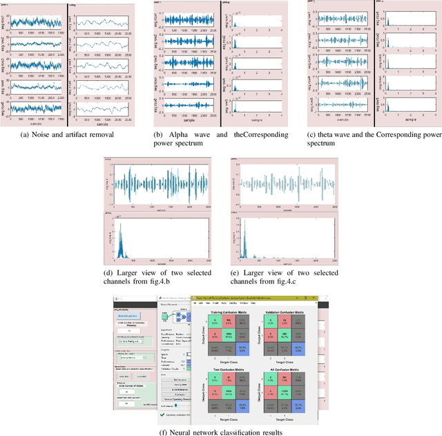 Figure 4 for EEGsig machine learning-based toolbox for End-to-End EEG signal processing